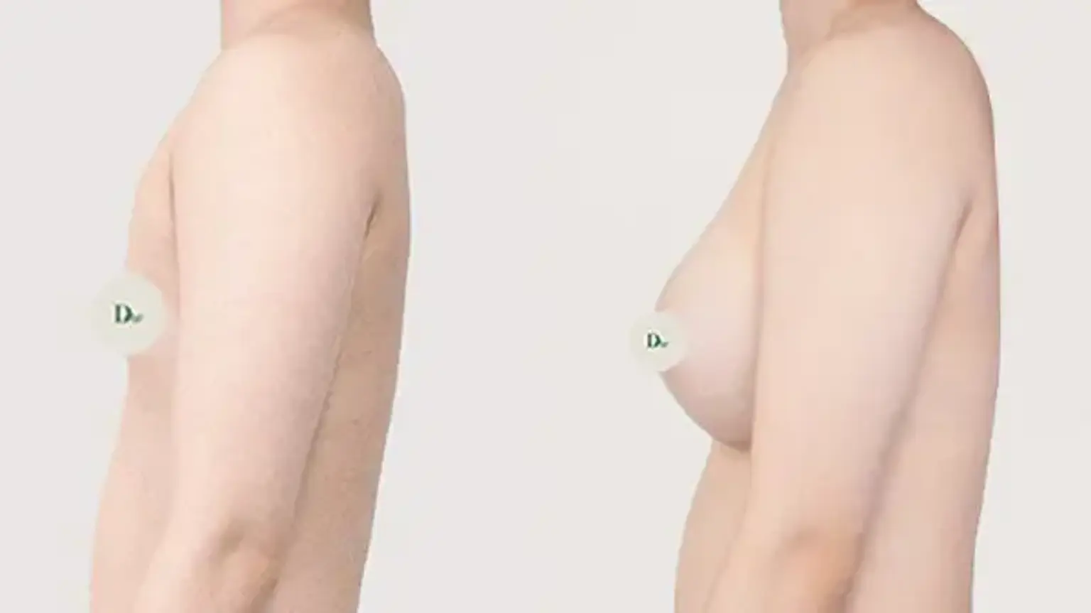 EVERA　韓国　美容　豊胸　美容整形　エベラ EVERA 韓国 美容 豊胸 美容整形 エベラ 【公式通販】